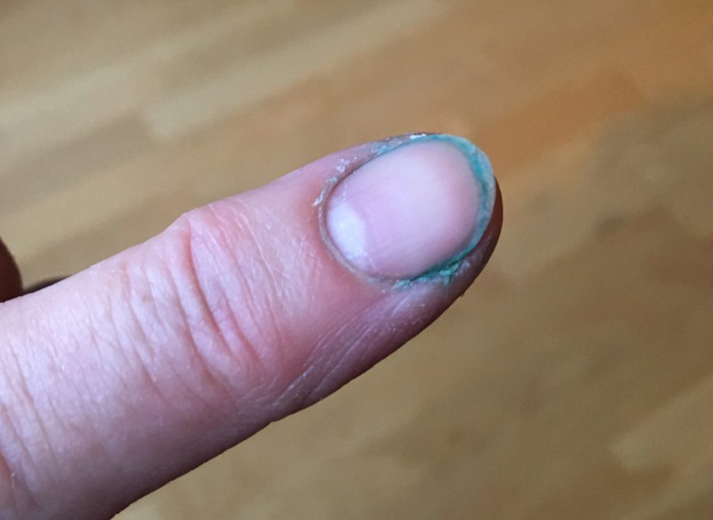 Blå under nageln!